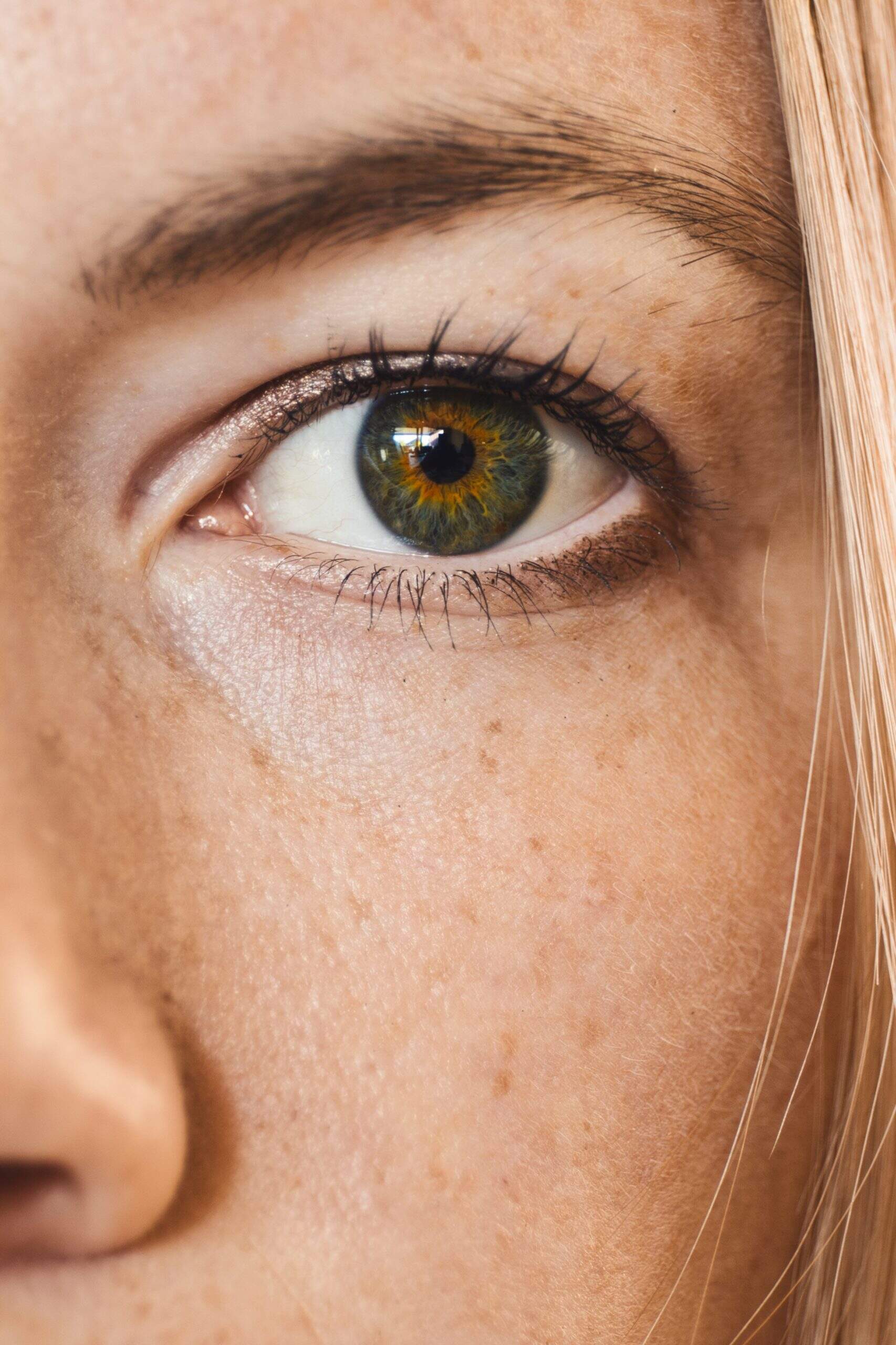 Ménopause et sécheresse cutanée, causes et solutions