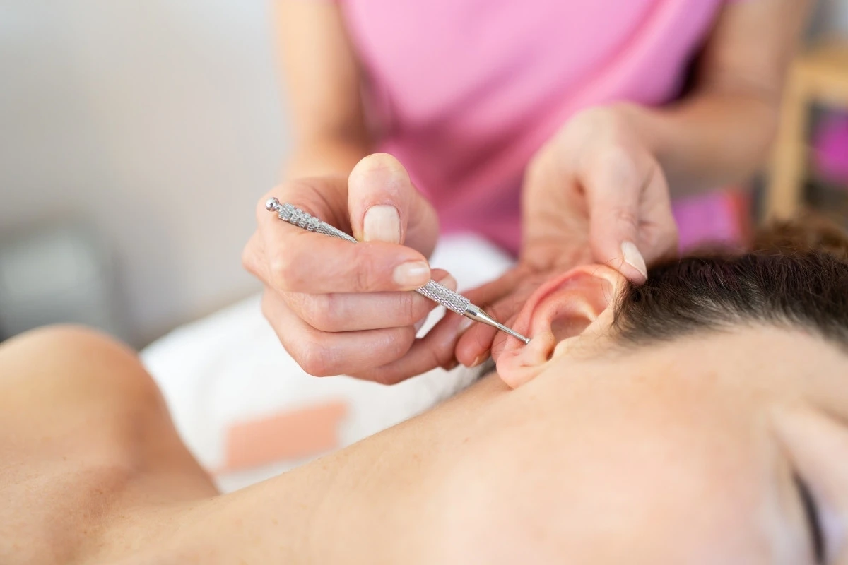 Auriculothérapeute qui pratique sur une cliente durant une séance d'auriculothérapie.