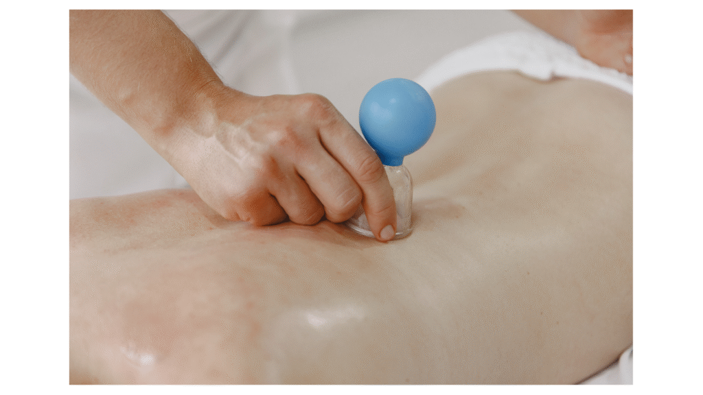 ventouse médecine traditionnelle chinoise