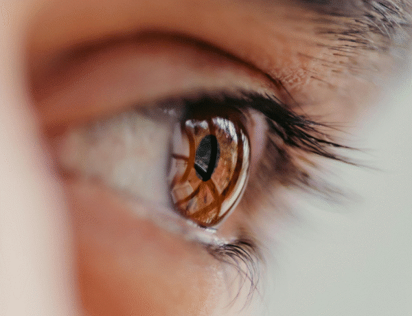 oeil